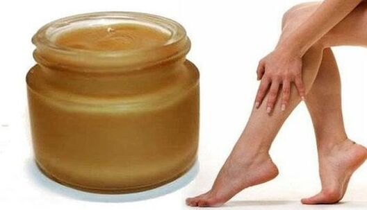 Varicose vein grease