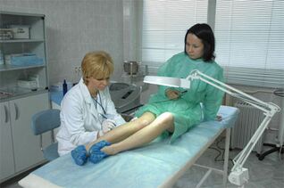 Laser therapy of varicose veins in the legs