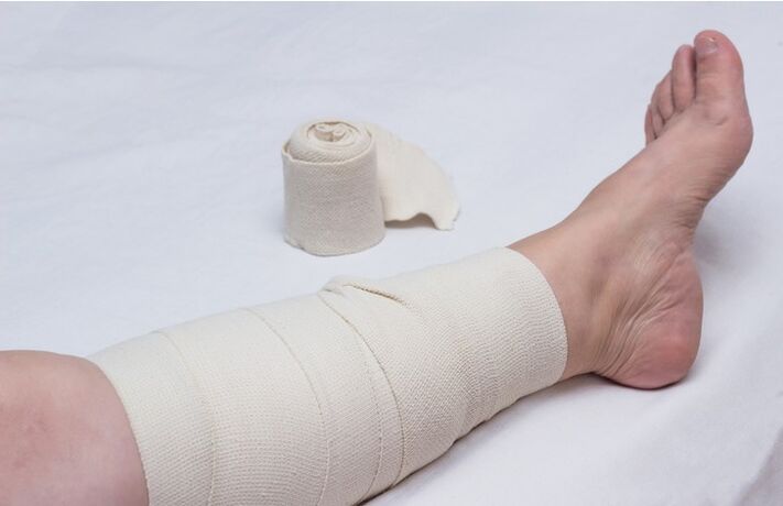 compression bandage on legs for varicose veins