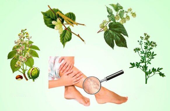 Herbs for the treatment of varicose veins on the legs