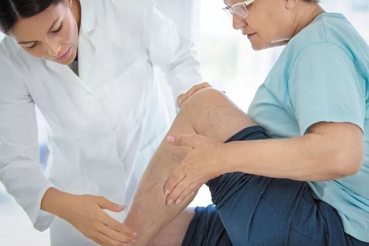 treatment of varicose veins at the doctor